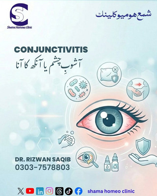 آشوبِ چشم Conjunctivitis 
