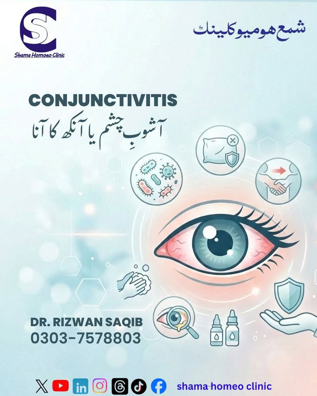 آشوبِ چشم Conjunctivitis 
