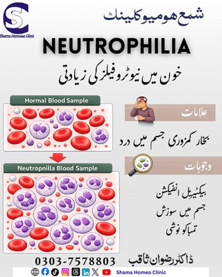  نیوٹروفیلیا (Neutrophilia):