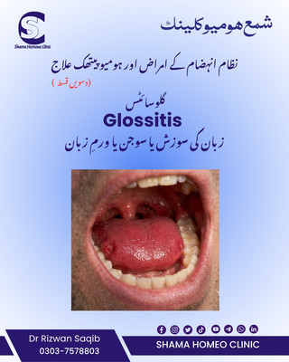 نظام انہضام کے امراض اور ہومیوپیتھی 