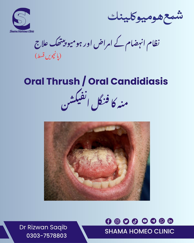 نظام انہضام کے امراض اور ہومیوپیتھی 
