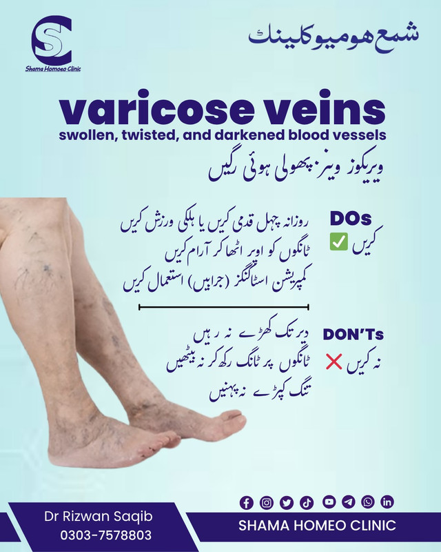 ویری کوس وینز