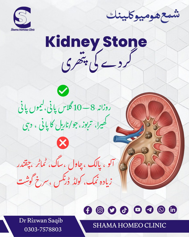 گردے میں پتھری kidney stones 
