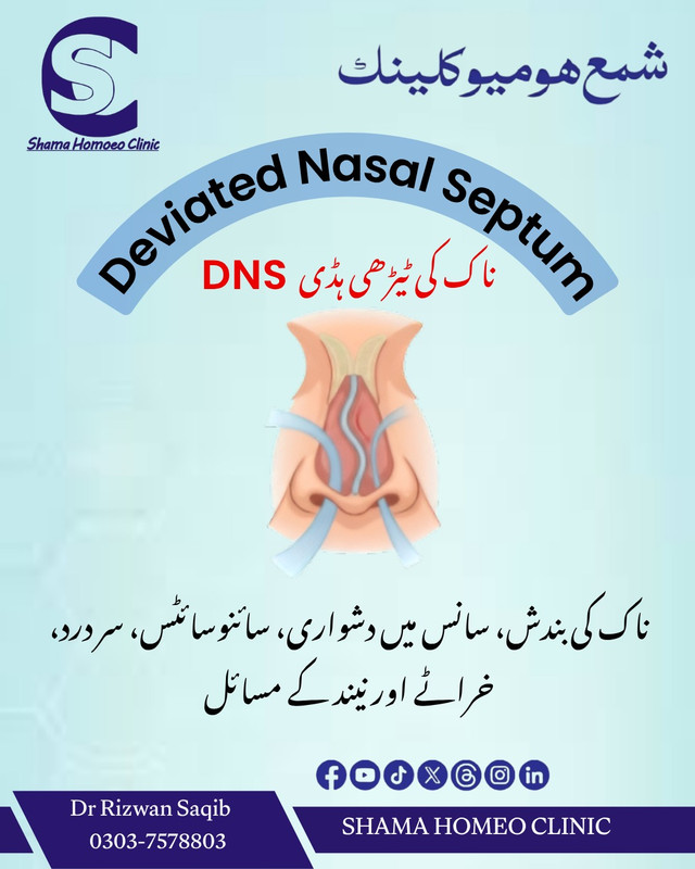 ناک کی ٹیڑھی ہڈی