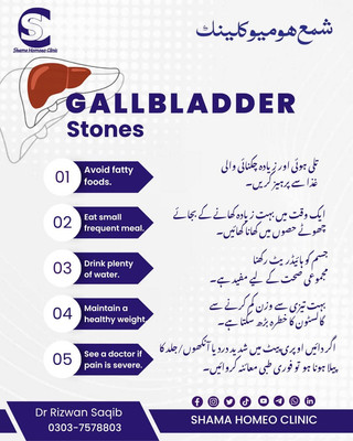 پتے کی پتھری کے مریضوں کے لیے  خصوصی ہدایات 