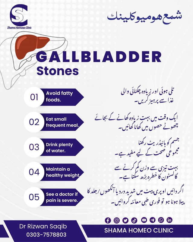 پتے کی پتھری کے مریضوں کے لیے  خصوصی ہدایات 