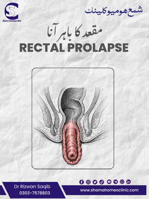 Rectal Prolapse کانچ نکلنا: