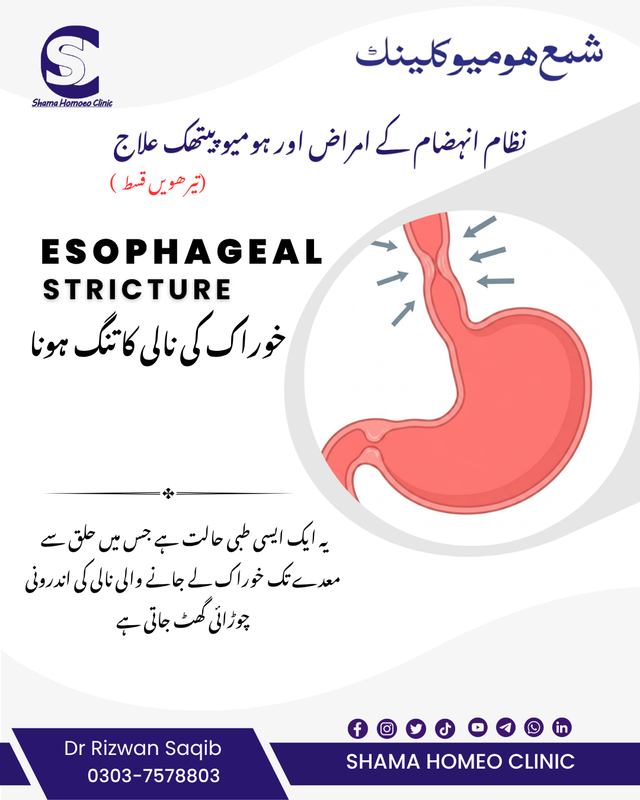 Esophageal Stricture