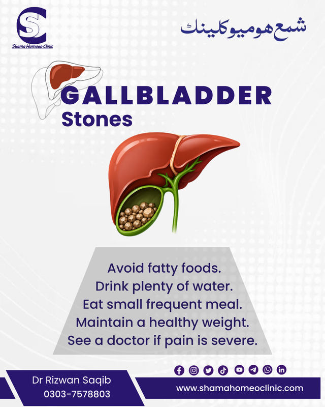 پتّے کی پتھریاں #Gallstones
